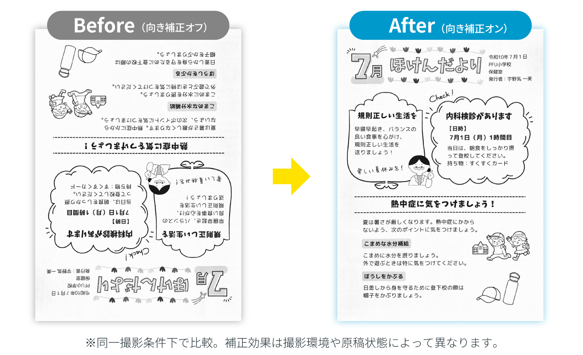 向き補正